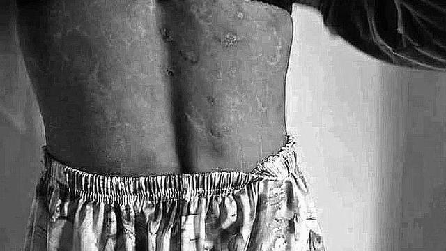 TKW Korban Penyiksaan