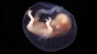 Ilustrasi embrio manusia. (Sumber Flickr/lunar caustic)