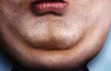 Fenomena 'Zoom Dysmorphia' dan 5 Penyebab Double Chin yang Seringkali Tak Disadari