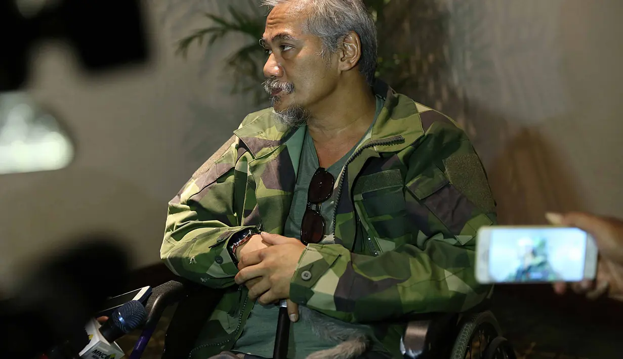 "Saya buka jahitan sendiri. Ini 30 jahitan di sini (paha)," ujar Tio Pakusadewo, di kawasan Kemang, Jakarta Selatan, Rabu (11/10/2017) seperti dilansir dari Liputan6. (Nurwahyunan/Bintang.com)