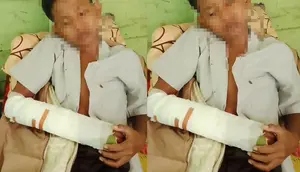 Ini Penyebab 2 Siswa SMP Berkelahi hingga Patah Tangan
