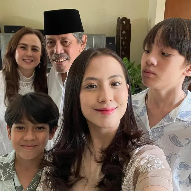 Adhisty Zara dan Acil Bimbo