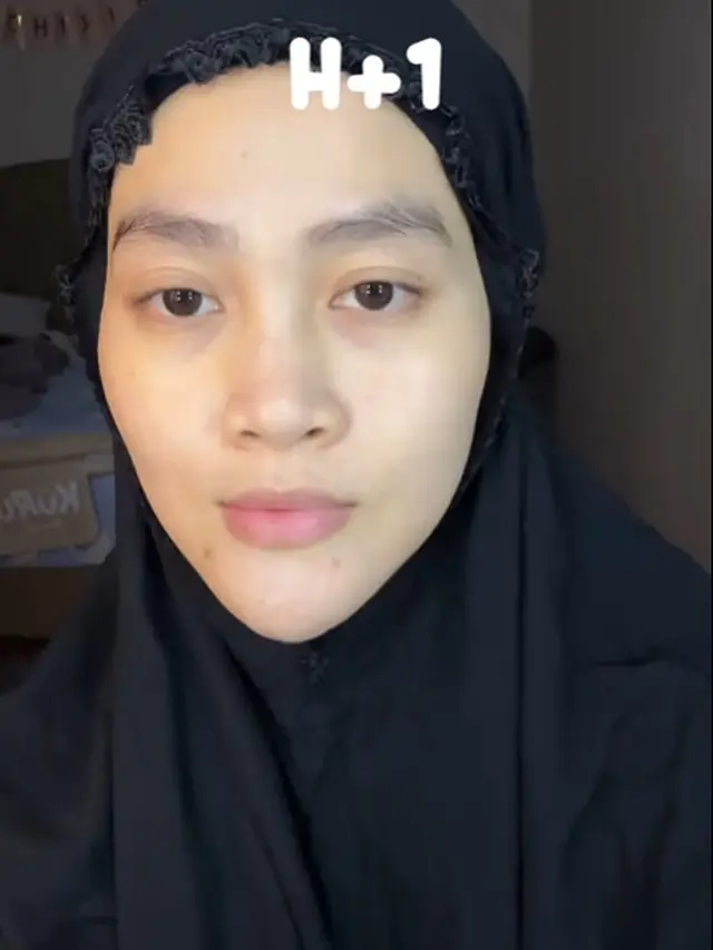6 Potret Perubahan Wajah Henny Rahman Setelah Perawatan, Makin Cerah dan Mulus