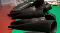 Terapi Bekam dengan Tanduk Kerbau, Apa Pula Itu?