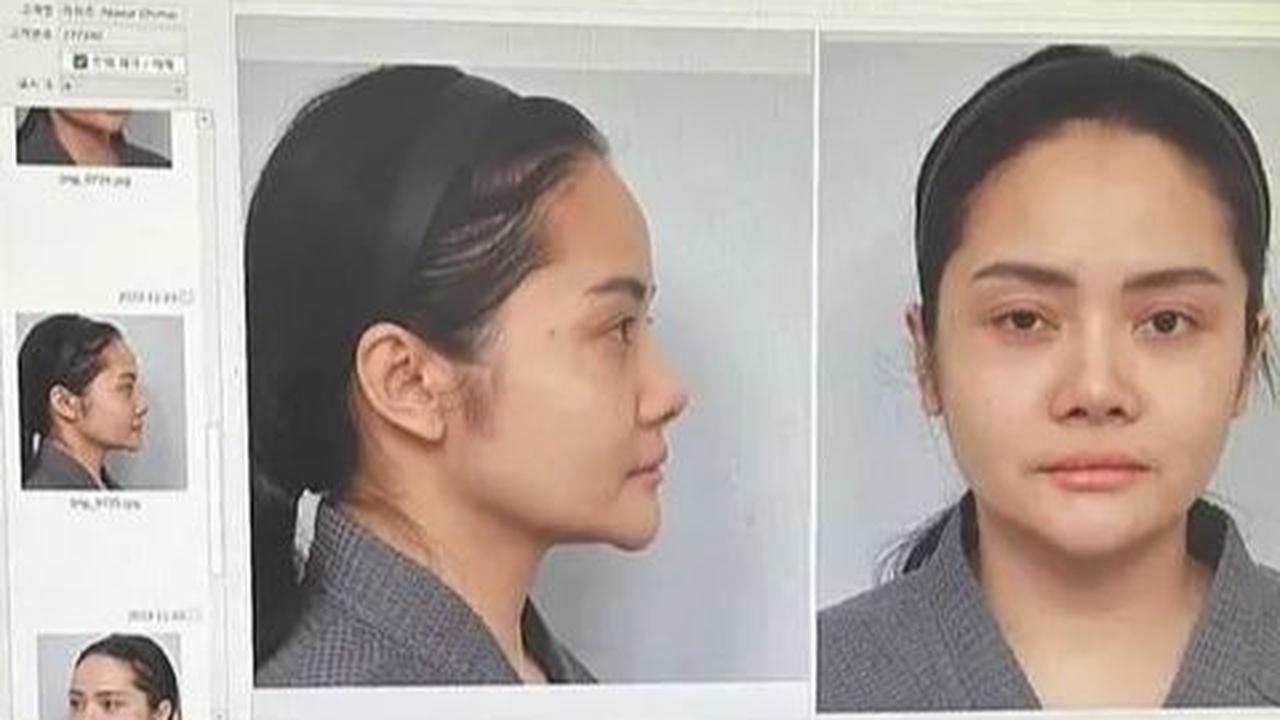 3. Mawar tak menyembunyikan persiapan menjelang operasinya, termasuk video sebelumnya yang memperlihatkan puasanya selama enam jam serta biaya perjalanan ke Korea yang tidak murah.