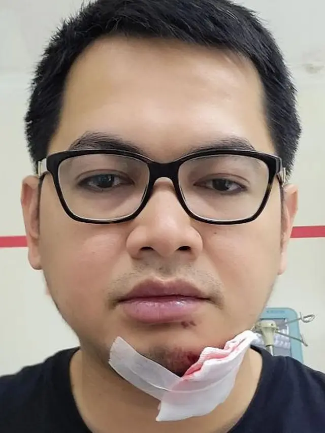 Tommy Kurniawan (Instagram/tommykurniawann)