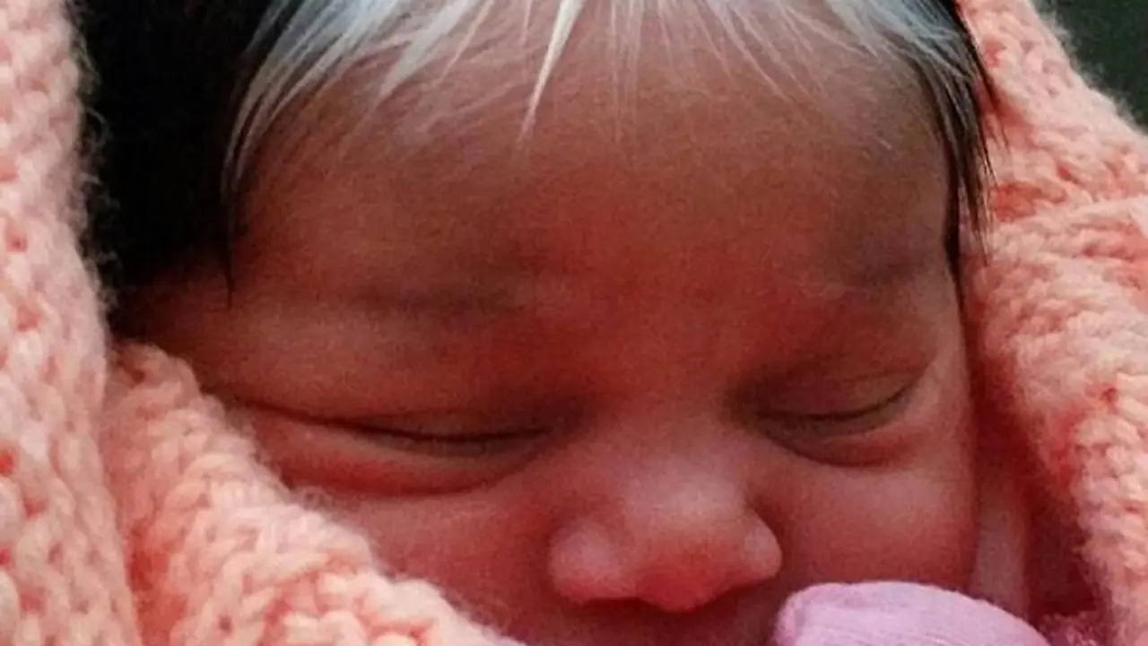 [Bintang] Lucunya! Bayi Ini Terlahir dengan Rambut Putih Kayak Di-bleaching