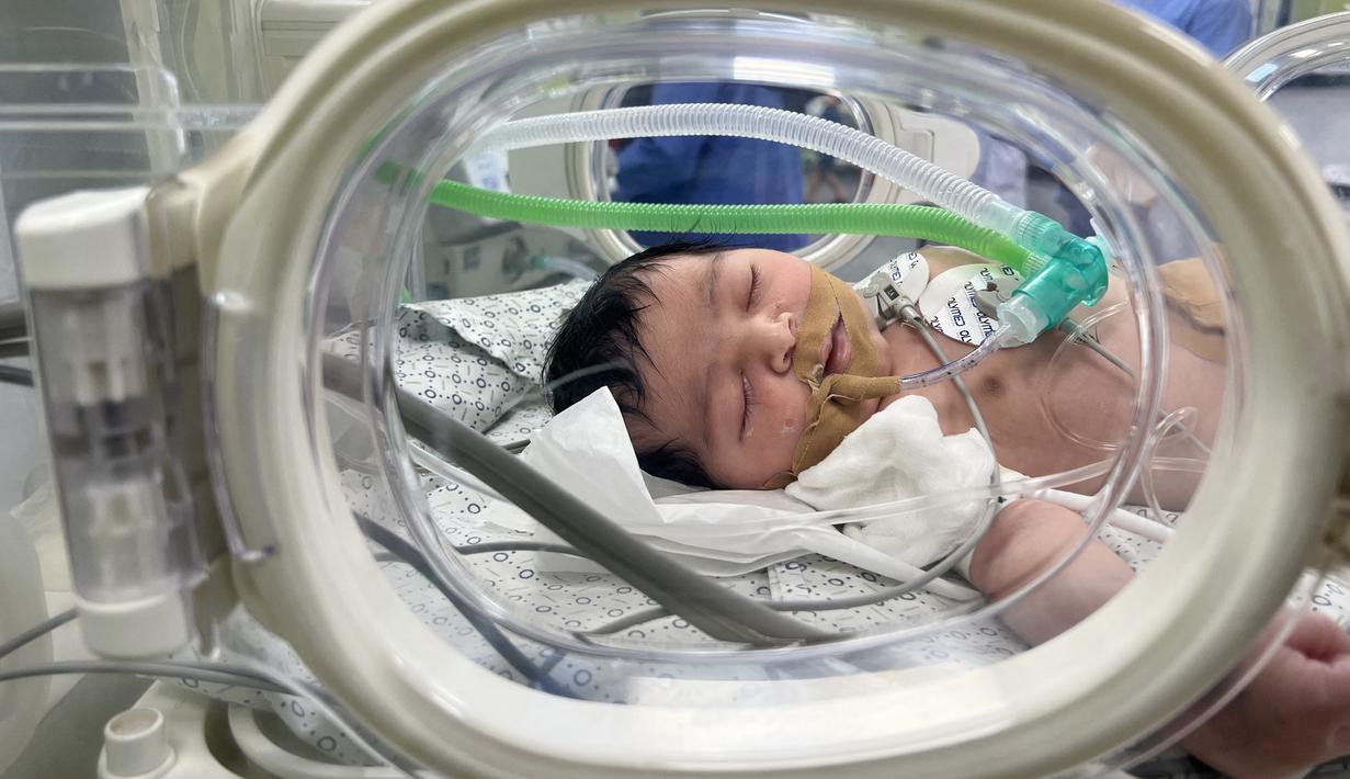 Mecca Abu Shamalah menerima perawatan di dalam inkubator di sebuah rumah sakit di Rafah pada 23 Oktober 2023. (Mai YAGHI / AFP)
