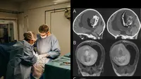 Penampakan CT Scan janin di dalam otak bayi (Sumber: Ilustrasi Pexels/jonathan-borba, Twitter/OGdukeneurosurg)