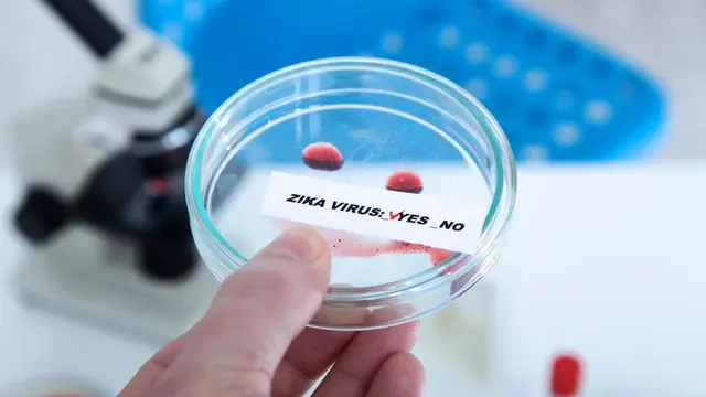 Ciri-Ciri Virus Zika