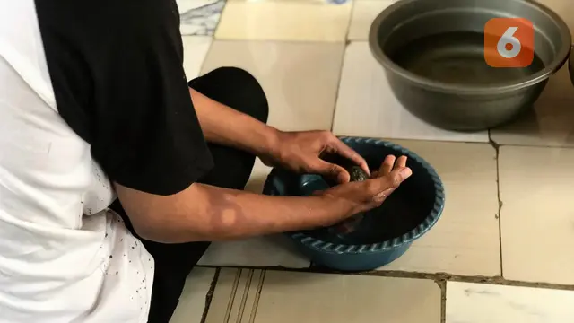 Obati Kusta Sebelum Berujung Disabilitas, Menkes Budi Jelaskan Ciri-cirinya