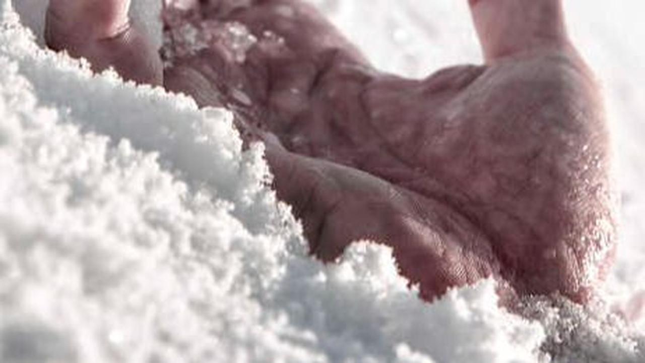 Mengenal Frostbite: Gejala, Tahap, dan Penyebabnya