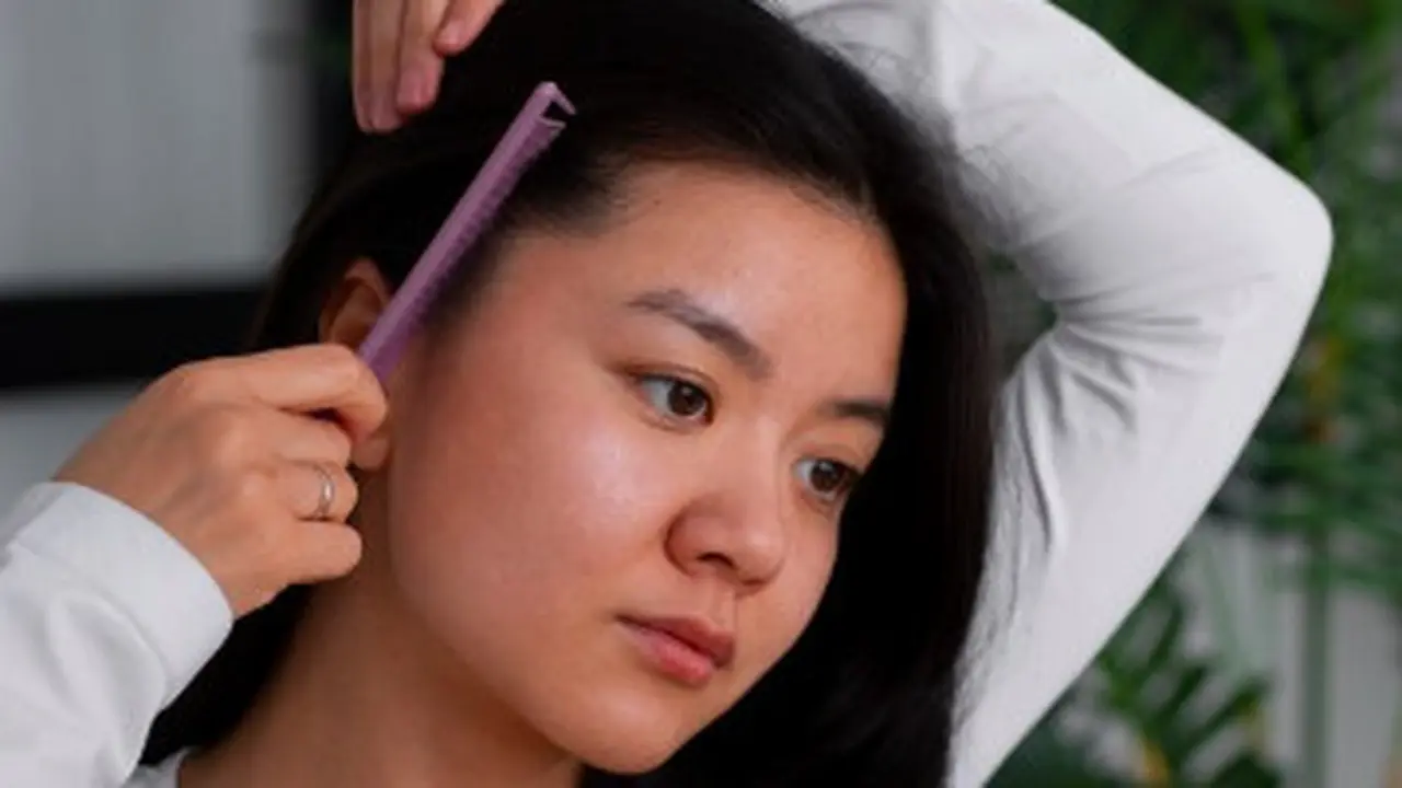 Rambut Menipis