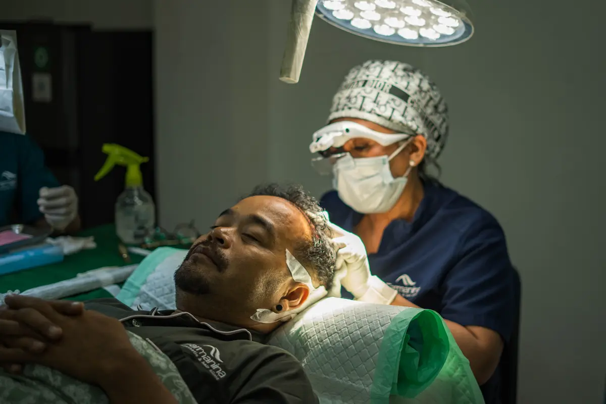 Transplantasi Rambut di Indonesia