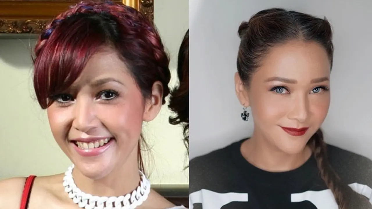 Potret Penyanyi Cantik Sebelum dan Sesudah Tanam Benang