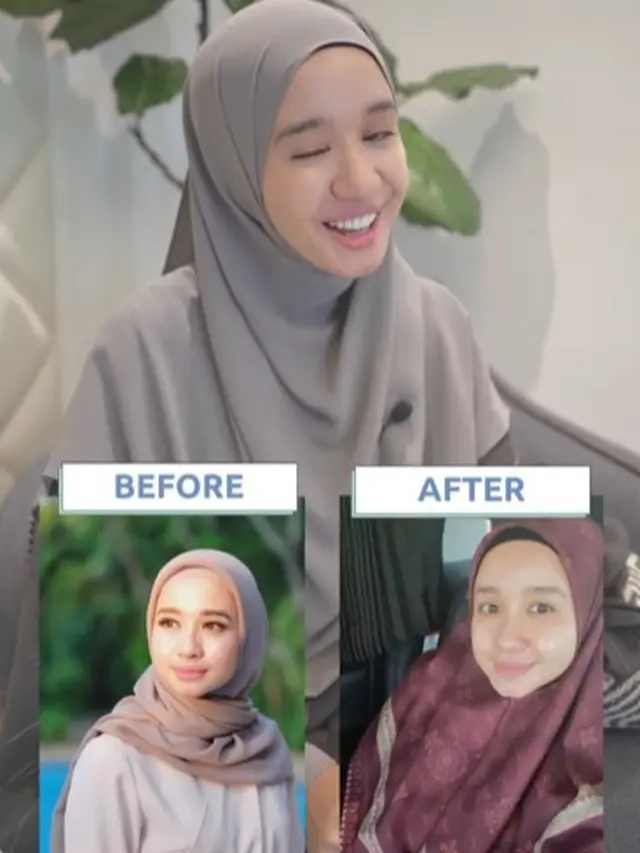 Laudya Cynthia Bella lakukan perawatan (Instagram/laudycynthiabella)