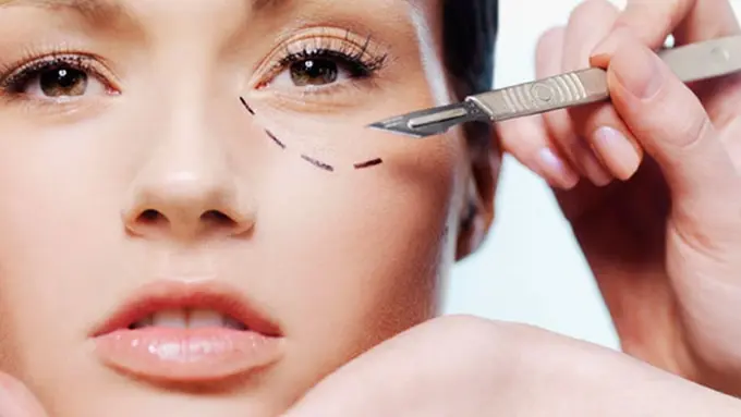 Ilustrasi (c) svejo.net