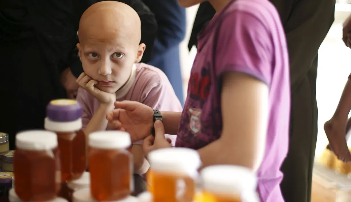 Seorang anak Palestina yang menderita alopecia areata menunggu untuk menerima terapi sengatan lebah di klinik Rateb Samour, Kota Gaza, 11 April 2016. Samour mengobati 250 pasien sehari dengan keluhan dari rambut rontok hingga kanker (REUTERS/Suhaib Salem)