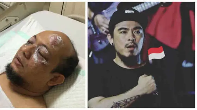 Novel Baswedan dan Beery Manoch/Instagram.