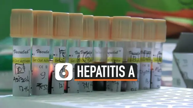 VIDEO: 20 Siswa SMP Terserang Hepatitis A