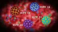 Selain pemeriksaan dini, bila wanita sudah aktif berhubungan seksual juga dirasa tepat untuk lakukan vaksin HPV
