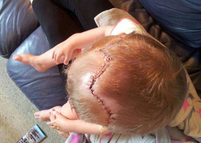 Charlie dengan jahitan operasi di kepalanya | foto: copyright dailymail.co.uk
