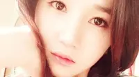 Eks Member Hello Venus Yoo Ara Berjuang Lawan Kanker, Lama Absen karena Jalani Operasi Tumor Ganas