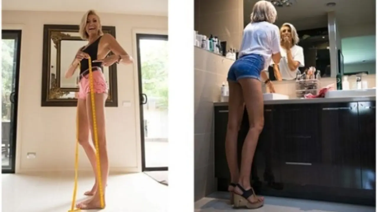 Wanita pemilik kaki terpanjang di Australia