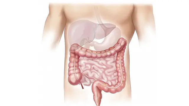 Usus