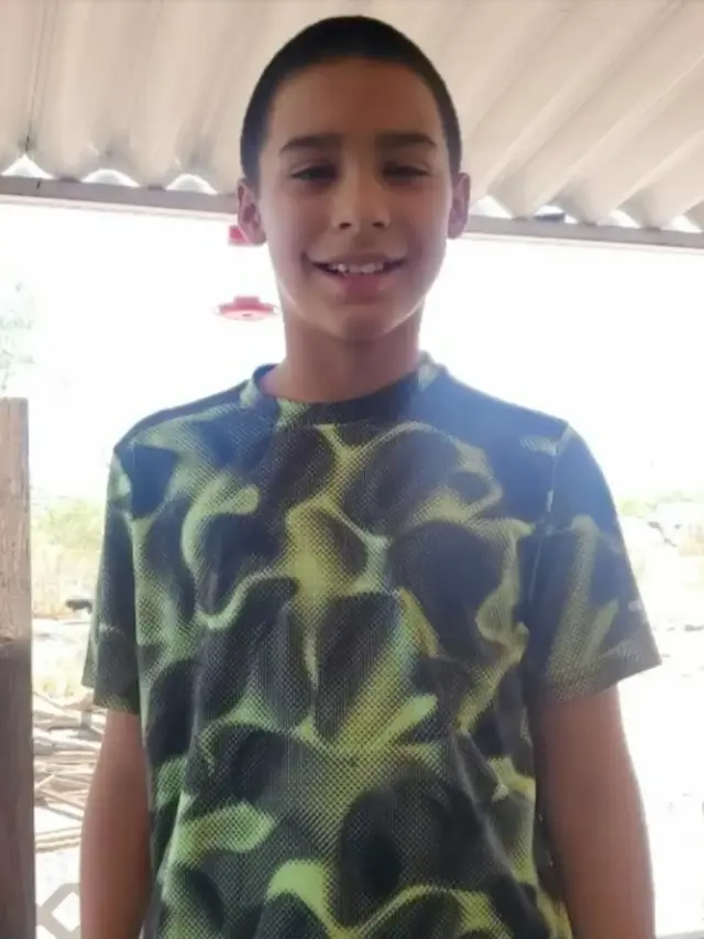 Ikut Challenge di TikTok, Remaja Ini Menderita Luka Bakar di Sekujur Tubuhnya