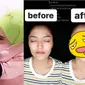 6 Potret Terbaru Siti Badriah Setelah Filler Bibir, Makin Seksi (sumber: Instagram.com/rezagladys)