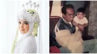 Potret Masa Kecil Nadya Mustika Bareng Keluarga. (Sumber: Instagram/nadyamustikarahayu)