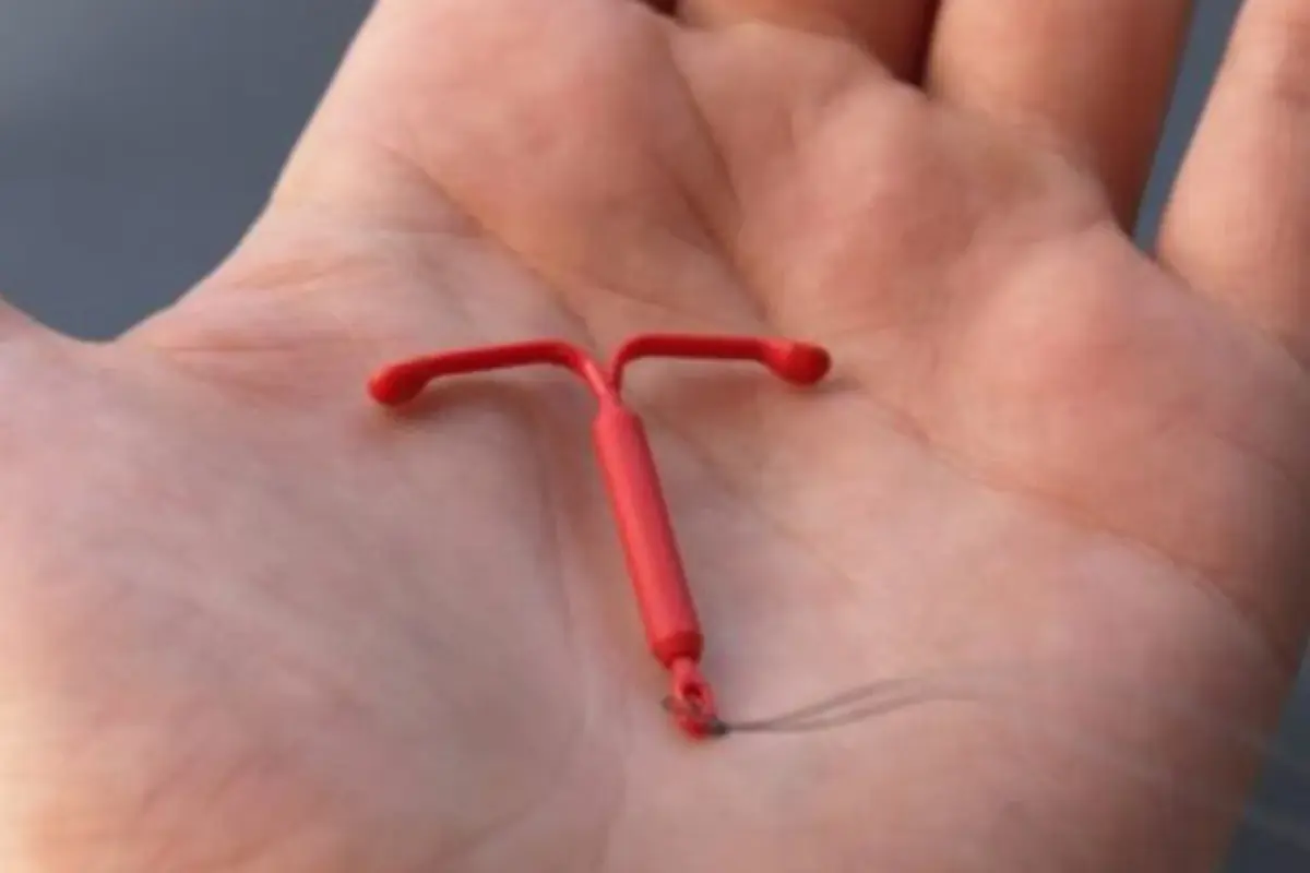 Ilustrasi KB IUD (Foto: Primaya Hospital)
