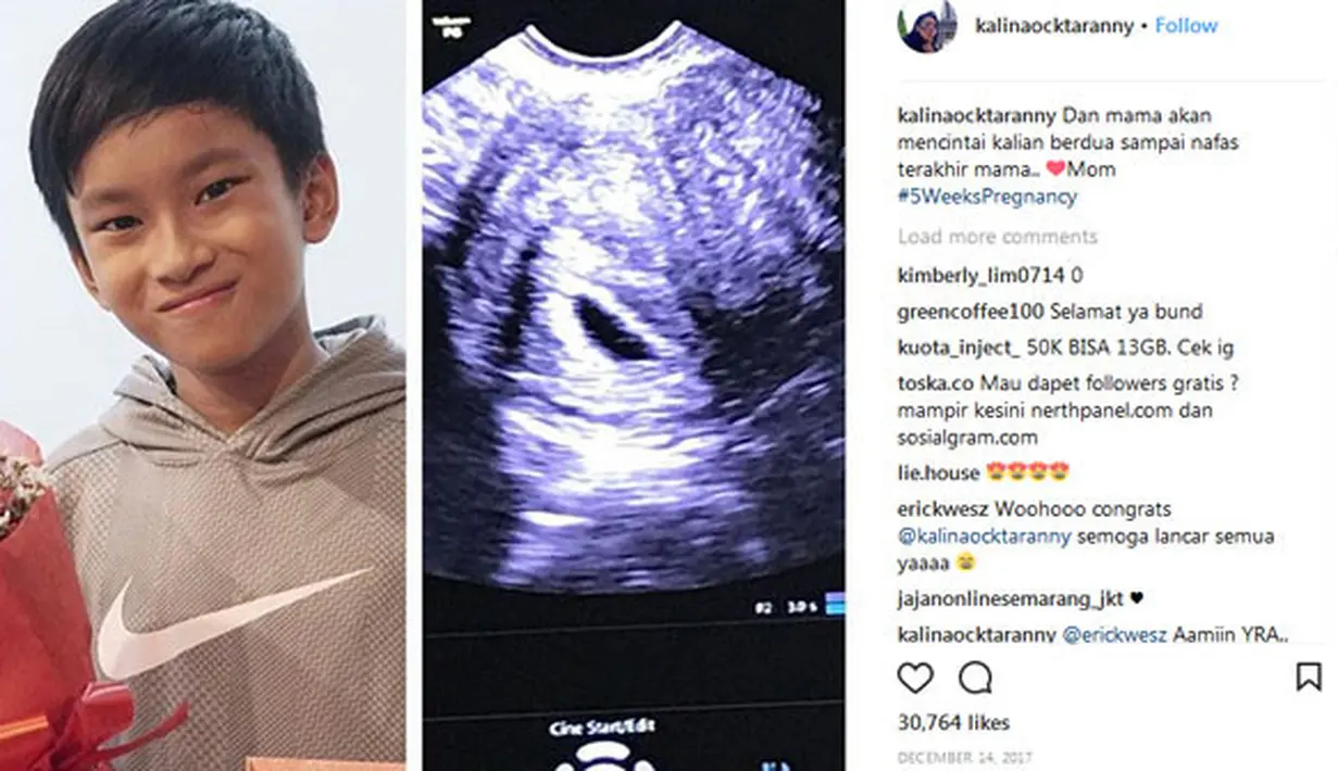 Sempat mengunggah foto hasil USG sebuah janin dan foto anak pertamanya, Azka, pada bulan Desember 2017 lalu menunjukan bahwa saat itu usia kehamilannya sudah lima minggu. (Instagram/kalinaocktaranny)