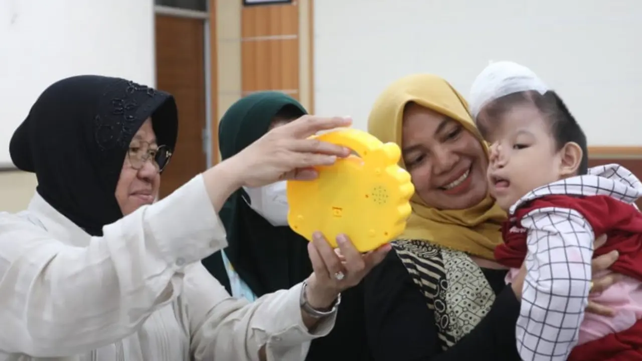 Bocah Penyandang Hidrosefalus Asal Indramayu Tunjukkan Perkembangan Baik usai Dapat Bantuan Pengobatan