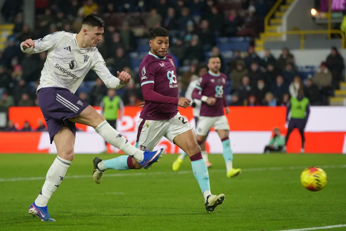 Burnley vs Manchester United