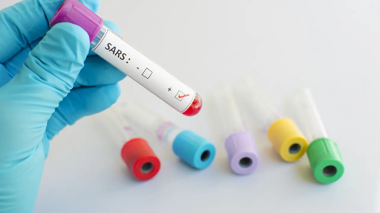 Penyakit SARS (Sumber: iStockphoto)