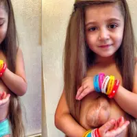 Dari luar gadis cilik ini memang seperti anak yang biasanya, tapi coba kamu lihat apa yang ada di balik bajunya. (Foto: mirror.co.uk)