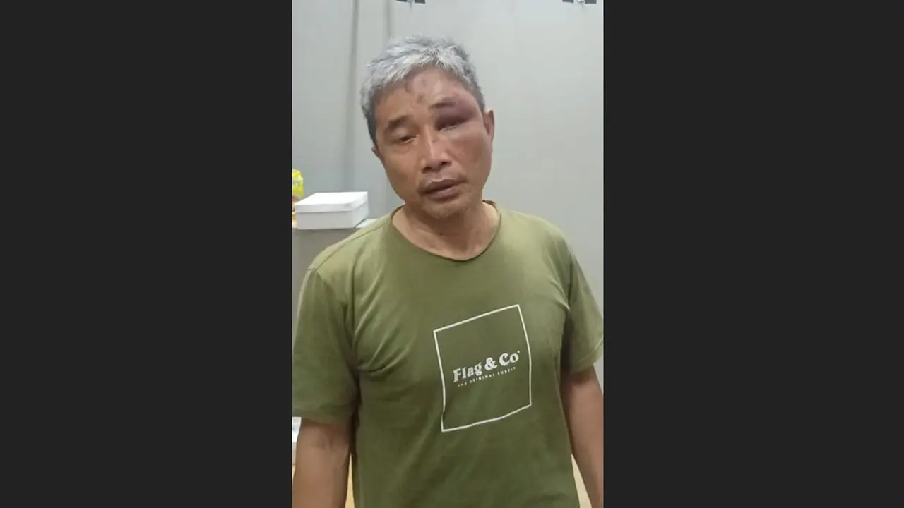 Foto terbaru Muhammad Kece dengan wajah lebam beredar di aplikasi perpesanan.