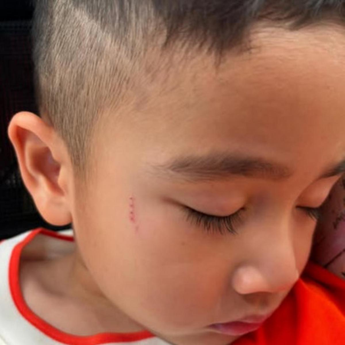 Drama Rayyanza dan Baby Lily yang Berujung Saling Cakar Hingga Gigit, Netizen 'Terpantau Masih 1-1 Skornya Guys'