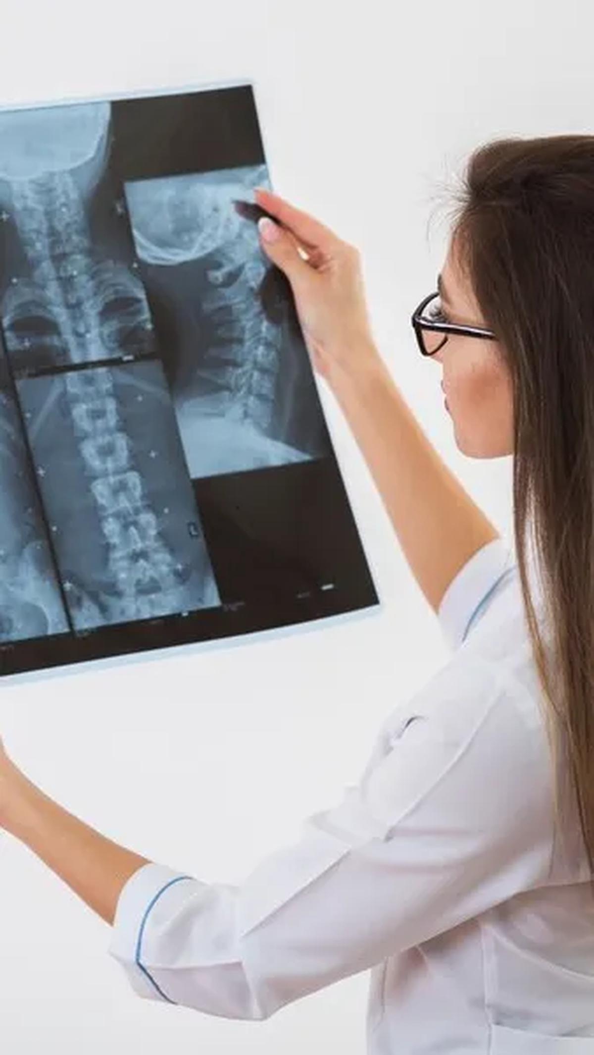 Tentang Osteoporosis