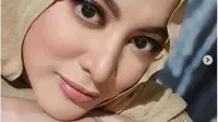 Kondisi Jane Shalimar Sempat Membaik Sebelum Meninggal Dunia