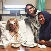 Sheila Marcia beserta temannya Melody Vanesha mengalami kecelakaan di jalan Semanggi, Jakarta Pusat, Sabtu (6/5) malam. Kejadian itu membuat wajahnya memar dan mengalami retak dibagian hidung. (Instagram/devi_nadia29)