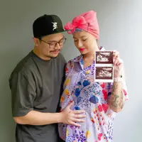 Melahirkan Anak Pertama, Ini Potret Perjalanan Kehamilan Istri Derby Romero. (Sumber: Instagram/derbyromero)