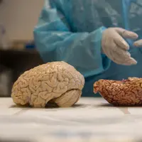 Para ilmuan dan dokter telah menemukan cara yang lebih efisien untuk mengoperasi otak. | via: nytimes.com