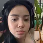 Transformasi Mawar AFI Sebelum dan Sesudah Oplas Hidung di Korsel (Instagram/mysamawar)