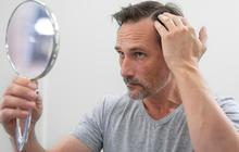 Wajib Tahu! Ini 10 Tips Ampuh Cegah Rambut Rontok untuk Pria yang Suka Pakai Pomade