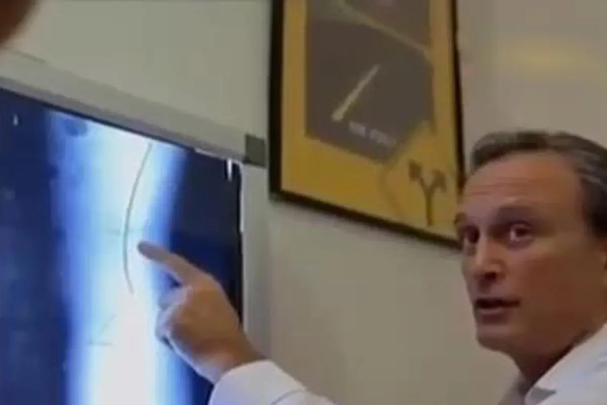 VIDEO: Apa Itu Terapi Chiropractic?
