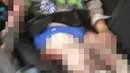 Tampak salah satu korban ledakan bom yang merupakan seorang polisi yang sedang bertugas. Ia mengalami luka parah di tubuhnya. (sumber: istimewa)
