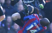 Tendangan Horor Kiper Millwall ke Wajah Striker Crystal Palace JP Mateta, Dibawa ke RS Dapat 25 Jahitan